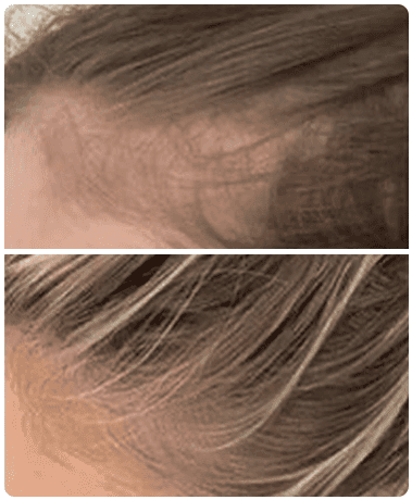 scalp-massager-user-review-01