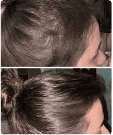 scalp-massager-user-review-04